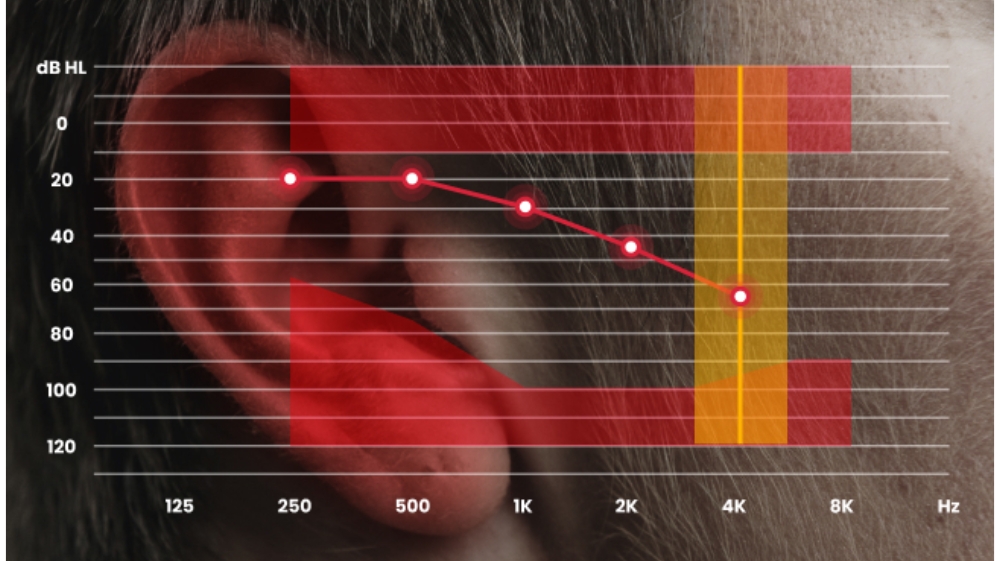Signia hearing aids overview