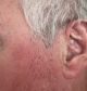 Genesis AI in the left ear with only the receiver wire barely visible to others