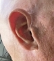 beige genesis ai hearing aid hiding discreetly behind the right ear