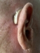 close up image of the actual geneisis device behind the ear with push buttons in view