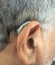 Right graphite grey genesis hearing aid behind the right ear blending in nicely with hair