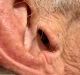Signia Silk IX hearing aid hiding inside the ear