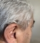 right oticon intent 2 in right ear close up image