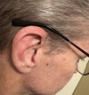 phonak sphere 90 RIC hearing aid behind the right ear