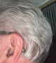 oticon intent 1 on left ear in silver grey