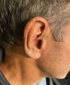 Oticon intent 2 close up on right ear
