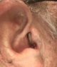 Signia Silk Charge&Go 7ix in right ear close up