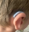 Oticon Intent 1 minirite R in sky blue on right ear
