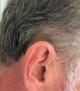 starkey edge ai 24 in chestnut on right ear closeup