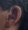 left resound enzo q9 in black with earmold in left ear