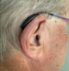 Right Phonak Sphere 90 in chestnut on ear
