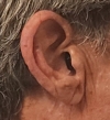 oticon zeal in right ear up close