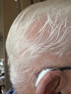 single phonak ultra sphere 90 in silver grey on right ear closeup