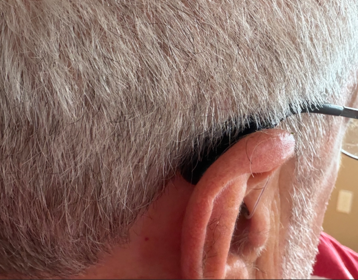 black signia pure charge&go 7ix on right ear close up from behind
