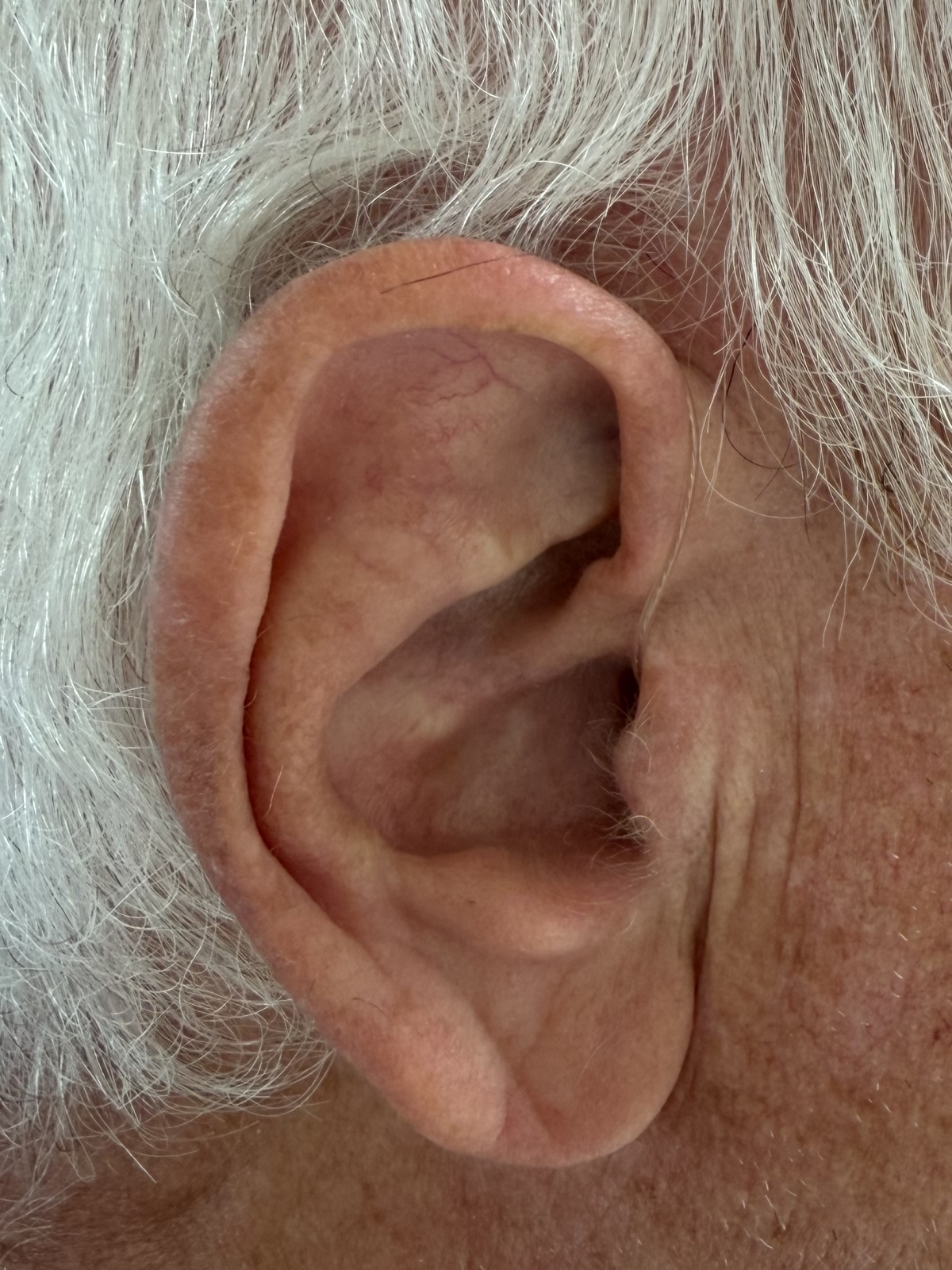 Phonak Audeo Infinio Ultra Sphere color champagne on right ear closeup