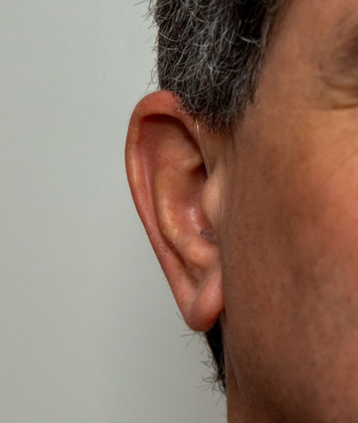 Starkey Omega AI 24 in graphite grey on right ear from in front