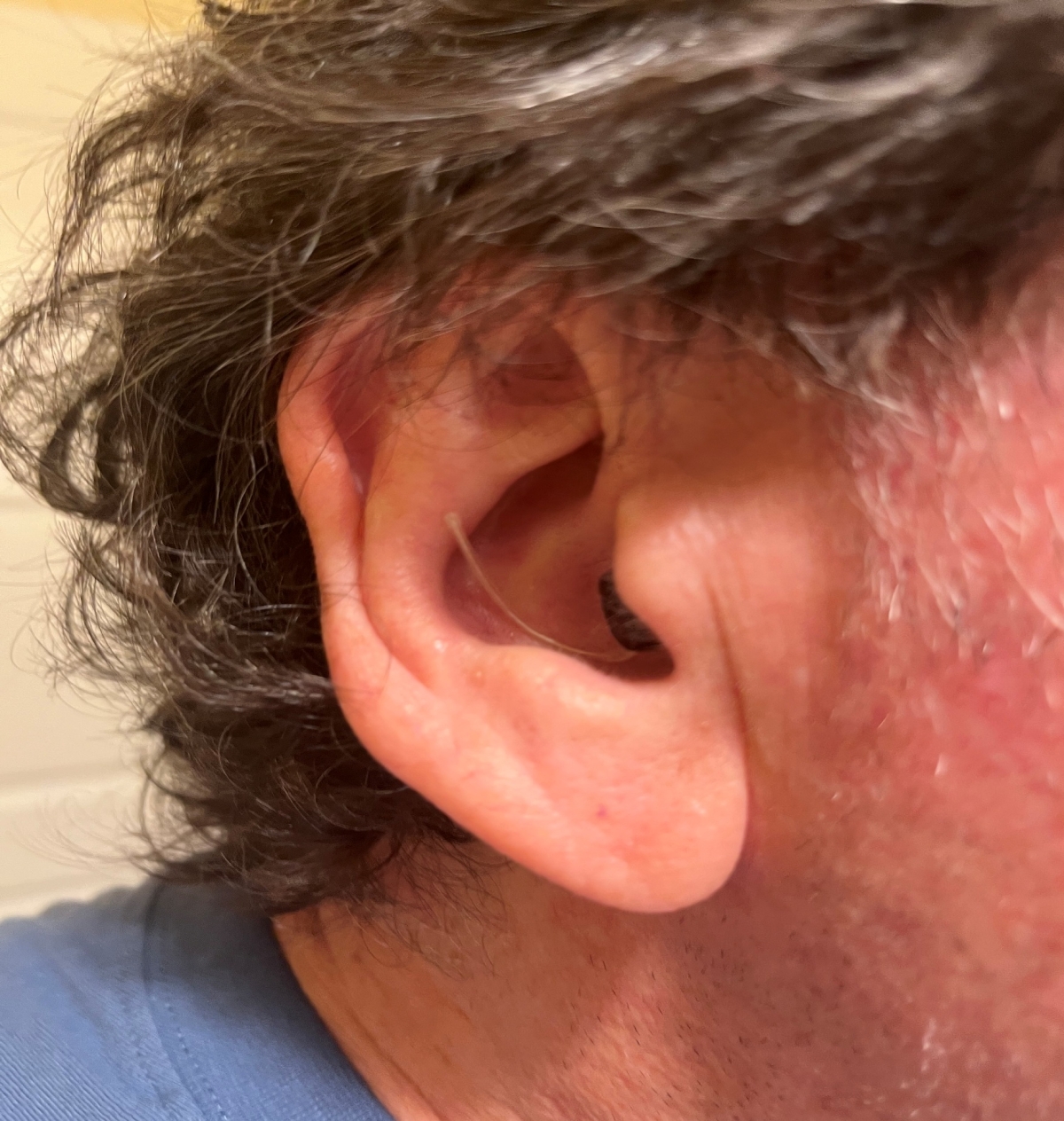 oticon zeal in users right ear