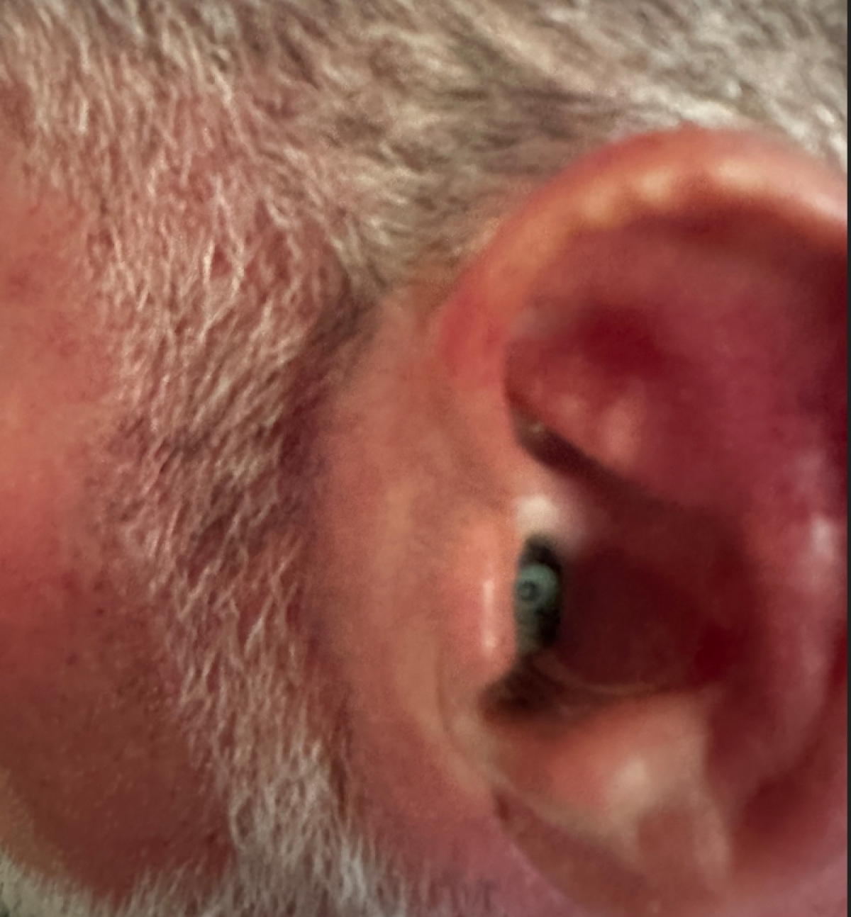 oticon zeal on left ear close up