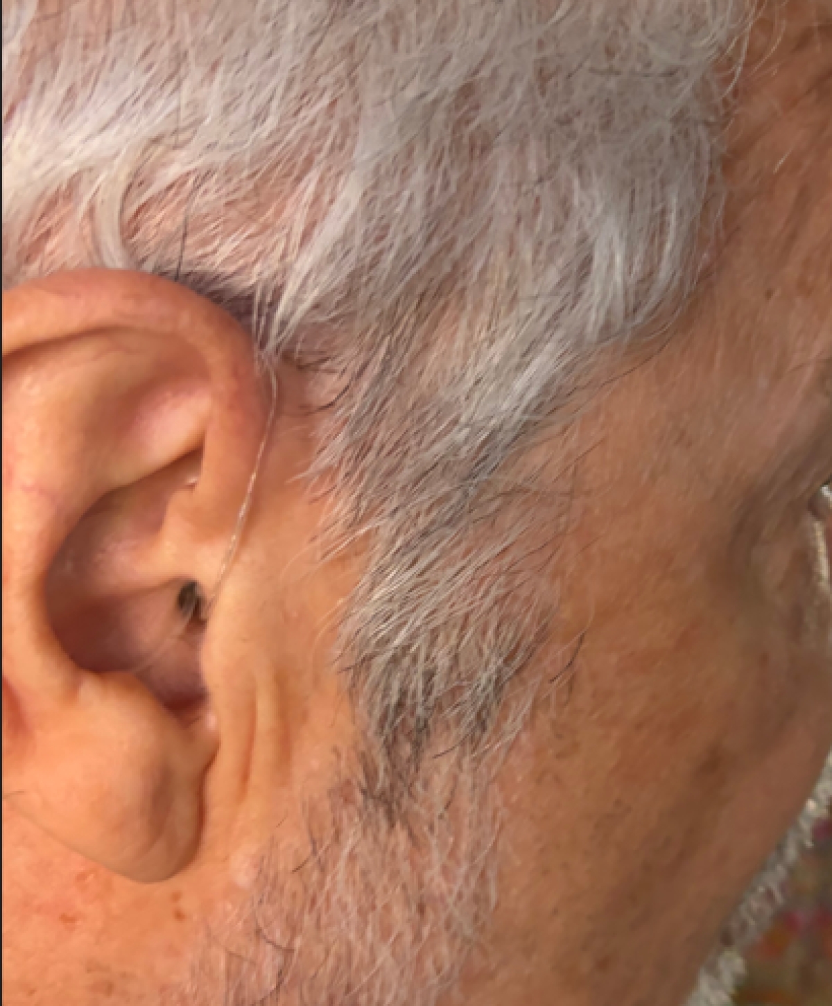 oticon intent 1 in silver on right ear close up