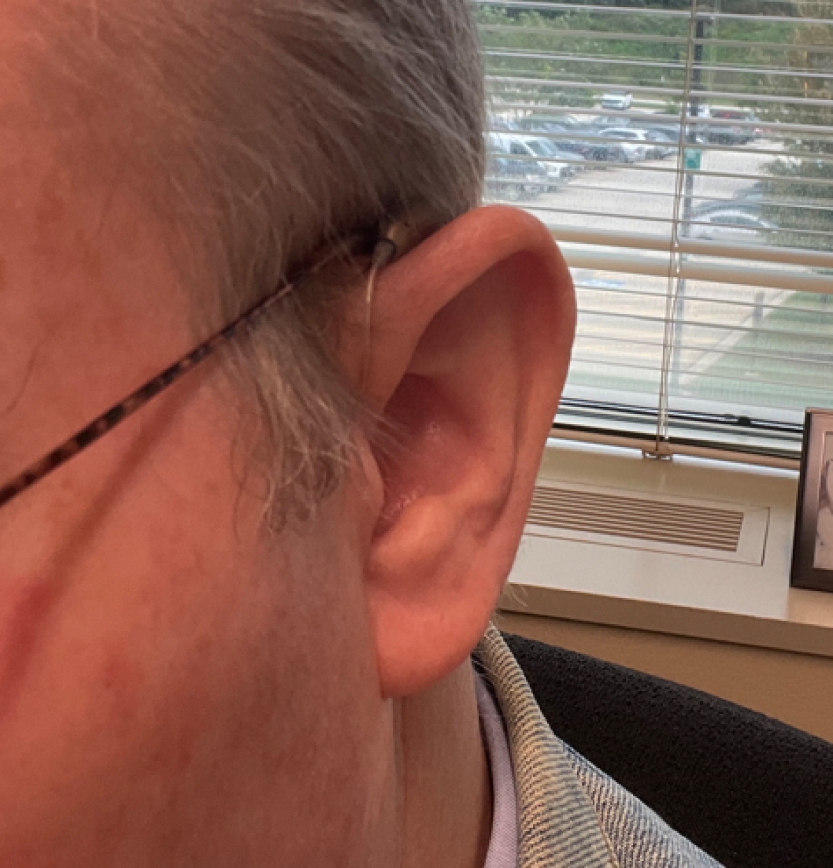 oticon reveal 1 minirite R in honey beige on left ear close up